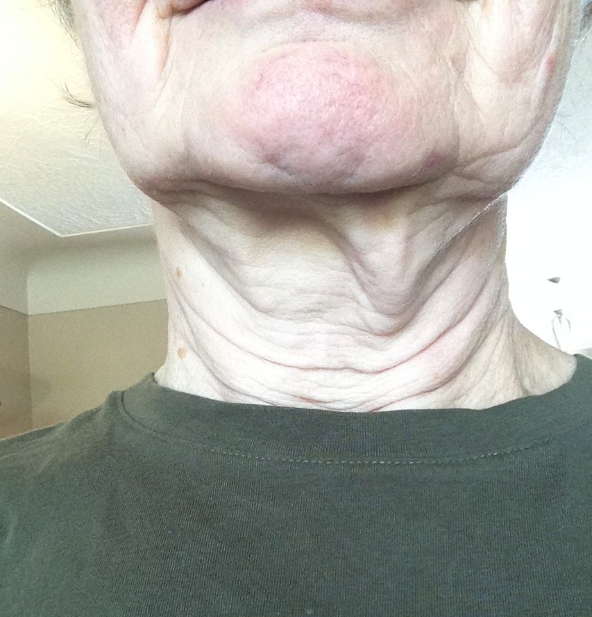 neck1